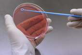 Các nhà khoa học sử dụng mẫu dò DNA để tìm ra vi khuẩn kiết lỵ