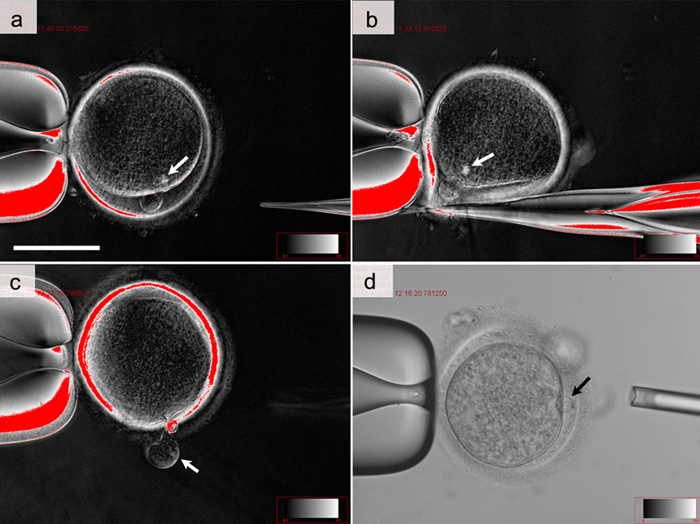체세포복제(somatic cell nuclear transfer, SCNT) 과정 (a) 공여된 인간난자 (b) knife pipette을 이용해 난자의 유전물질이 있는 부분 아래 투명대를 절개함 (C) knife pipette로 세포질을 밀어 난자의 유전물질이 포함된 세포질을 제거 (d) 성인 남성의 체세포(화살표)를 핵을 제거한 난자의 투명대 아래에 밀어 넣고 융합을 유도 (이미지: 차병원 줄기세포연구소)